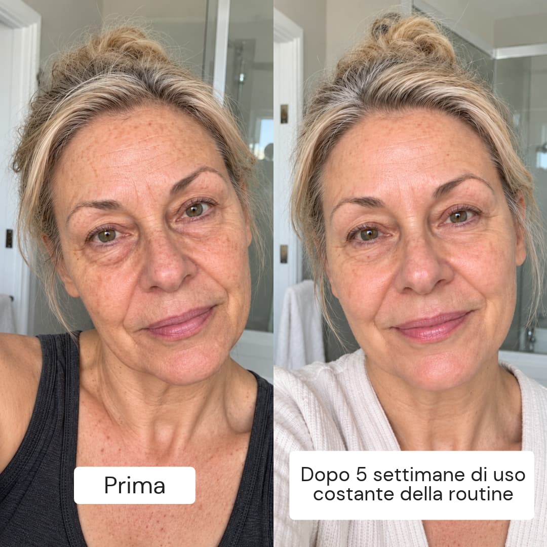 Routine Pelle Matura
